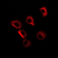 GOLM1 / GP73 / GOLPH2 Antibody - Immunofluorescent analysis of GP73 staining in MCF7 cells. Formalin-fixed cells were permeabilized with 0.1% Triton X-100 in TBS for 5-10 minutes and blocked with 3% BSA-PBS for 30 minutes at room temperature. Cells were probed with the primary antibody in 3% BSA-PBS and incubated overnight at 4 deg C in a humidified chamber. Cells were washed with PBST and incubated with a DyLight 594-conjugated secondary antibody (red) in PBS at room temperature in the dark.