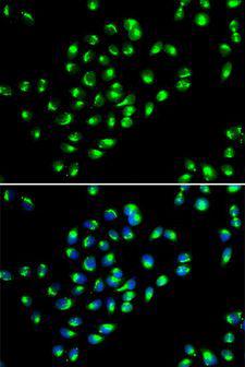 GOLM1 / GP73 / GOLPH2 Antibody - Immunofluorescence analysis of MCF-7 cells using GOLM1 antibody. Blue: DAPI for nuclear staining.