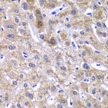 GOLM1 / GP73 / GOLPH2 Antibody - Immunohistochemistry of paraffin-embedded human liver injury using GOLM1 antibody at dilution of 1:100 (40x lens).