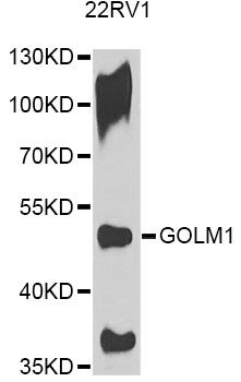 GOLM1 / GP73 / GOLPH2 Antibody - Western blot analysis of extracts of 22RV1 cells, using GOLM1 antibody at 1:1000 dilution. The secondary antibody used was an HRP Goat Anti-Rabbit IgG (H+L) at 1:10000 dilution. Lysates were loaded 25ug per lane and 3% nonfat dry milk in TBST was used for blocking. An ECL Kit was used for detection and the exposure time was 90s.