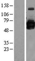 GOLM1 / GP73 / GOLPH2 Protein - Western validation with an anti-DDK antibody * L: Control HEK293 lysate R: Over-expression lysate