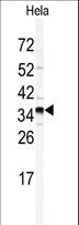 GOLPH3 Antibody - Western blot of GOLPH3 antibody in HeLa cell line lysates (35 ug/lane). GOLPH3 (arrow) was detected using the purified antibody.