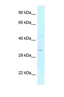 GOLPH3 Antibody - GOLPH3 antibody Western blot of Fetal Liver lysate. Antibody concentration 1 ug/ml.  This image was taken for the unconjugated form of this product. Other forms have not been tested.