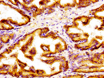 GOLPH3 Antibody - Immunohistochemistry image of paraffin-embedded human prostate tissue at a dilution of 1:100