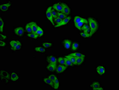 GOLPH3 Antibody - Immunofluorescence staining of HepG2 cells with GOLPH3 Antibody at 1:133, counter-stained with DAPI. The cells were fixed in 4% formaldehyde, permeabilized using 0.2% Triton X-100 and blocked in 10% normal Goat Serum. The cells were then incubated with the antibody overnight at 4°C. The secondary antibody was Alexa Fluor 488-congugated AffiniPure Goat Anti-Rabbit IgG(H+L).