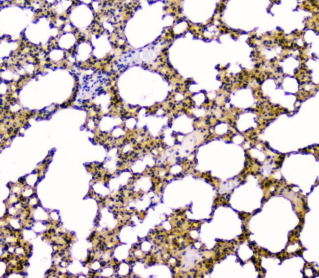 GOLPH3 Antibody - IHC analysis of GOLPH3 using anti-GOLPH3 antibody. GOLPH3 was detected in paraffin-embedded section of mouse lung tissues. Heat mediated antigen retrieval was performed in citrate buffer (pH6, epitope retrieval solution) for 20 mins. The tissue section was blocked with 10% goat serum. The tissue section was then incubated with 1µg/ml rabbit anti-GOLPH3 Antibody overnight at 4°C. Biotinylated goat anti-rabbit IgG was used as secondary antibody and incubated for 30 minutes at 37°C. The tissue section was developed using Strepavidin-Biotin-Complex (SABC) with DAB as the chromogen.