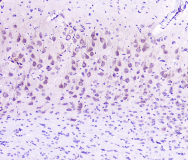 GOLPH3 Antibody - IHC analysis of GOLPH3 using anti-GOLPH3 antibody. GOLPH3 was detected in paraffin-embedded section of rat brain tissue. Heat mediated antigen retrieval was performed in citrate buffer (pH6, epitope retrieval solution) for 20 mins. The tissue section was blocked with 10% goat serum. The tissue section was then incubated with 2µg/ml rabbit anti-GOLPH3 Antibody overnight at 4°C. Biotinylated goat anti-rabbit IgG was used as secondary antibody and incubated for 30 minutes at 37°C. The tissue section was developed using Strepavidin-Biotin-Complex (SABC) with DAB as the chromogen.