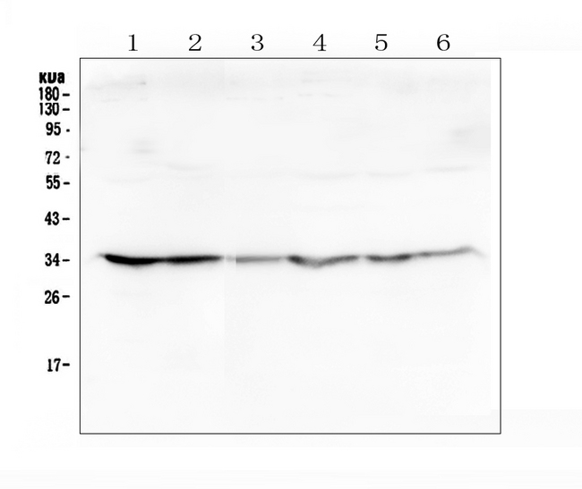 GOLPH3 Antibody - Western blot analysis of GOLPH3 using anti-GOLPH3 antibody. Electrophoresis was performed on a 5-20% SDS-PAGE gel at 70V (Stacking gel) / 90V (Resolving gel) for 2-3 hours. The sample well of each lane was loaded with 50ug of sample under reducing conditions. Lane 1: human Hela whole cell lysate,Lane 2: human placenta tissue lysates,Lane 3: human U20S whole cell lysate,Lane 4: human Caco-2 whole cell lysate,Lane 5: human SW620 whole cell lysate,Lane 6: human A549 whole cell lysate. After Electrophoresis, proteins were transferred to a Nitrocellulose membrane at 150mA for 50-90 minutes. Blocked the membrane with 5% Non-fat Milk/ TBS for 1.5 hour at RT. The membrane was incubated with rabbit anti-GOLPH3 antigen affinity purified polyclonal antibody at 0.5 µg/mL overnight at 4°C, then washed with TBS-0.1% Tween 3 times with 5 minutes each and probed with a goat anti-rabbit IgG-HRP secondary antibody at a dilution of 1:10000 for 1.5 hour at RT. The signal is developed using an Enhanced Chemiluminescent detection (ECL) kit with Tanon 5200 system. A specific band was detected for GOLPH3 at approximately 34KD. The expected band size for GOLPH3 is at 34KD.