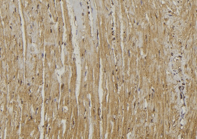 GOLPH3 Antibody - 1:100 staining mouse muscle tissue by IHC-P. The sample was formaldehyde fixed and a heat mediated antigen retrieval step in citrate buffer was performed. The sample was then blocked and incubated with the antibody for 1.5 hours at 22°C. An HRP conjugated goat anti-rabbit antibody was used as the secondary.