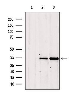 GOLPH3 Antibody - Western blot analysis of extracts of various samples using GOLPH3 antibody. Lane 1: rat brain treated with blocking peptide. Lane 2: rat brain; Lane 3: mouse brain;
