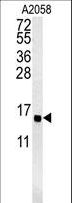 GOLT1A Antibody - GOT1A Antibody western blot of A2058 cell line lysates (15 ug/lane). The GOT1A antibody detected the GOT1A protein (arrow).