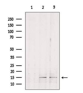 GOLT1B Antibody - Western blot analysis of extracts of various samples using GOLT1B antibody. Lane 1: mouse brain treated with blocking peptide. Lane 2: mouse brain; Lane 3: rat brain;