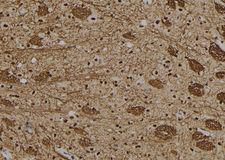 GON4L Antibody - 1:100 staining rat brain tissue by IHC-P. The sample was formaldehyde fixed and a heat mediated antigen retrieval step in citrate buffer was performed. The sample was then blocked and incubated with the antibody for 1.5 hours at 22°C. An HRP conjugated goat anti-rabbit antibody was used as the secondary.