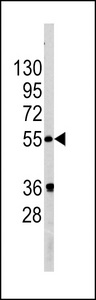 GOPC / PIST Antibody - Western blot of PIST Antibody in A375 cell line lysates (35 ug/lane). PIST (arrow) was detected using the purified antibody.