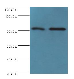 GOPC / PIST Antibody - Western blot. All lanes: GOPC antibody at 4 ug/ml. Lane 1: K562 whole cell lysate. Lane 2: HepG2 whole cell lysate. Secondary antibody: Goat polyclonal to rabbit at 1:10000 dilution. Predicted band size: 51 kDa. Observed band size: 51 kDa.
