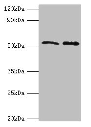 GOPC / PIST Antibody - Western blot All lanes: GOPC antibody at 4µg/ml Lane 1: K562 whole cell lysate Lane 2: HepG2 whole cell lysate Secondary Goat polyclonal to rabbit IgG at 1/10000 dilution Predicted band size: 51, 50, 36 kDa Observed band size: 51 kDa