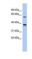 GOPC / PIST Antibody - GOPC / PIST antibody Western blot of HeLa lysate. This image was taken for the unconjugated form of this product. Other forms have not been tested.