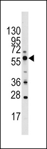 GOPC / PIST Antibody - Western blot of PIST Antibody in Ramos cell line lysates (35 ug/lane). PIST (arrow) was detected using the purified antibody.