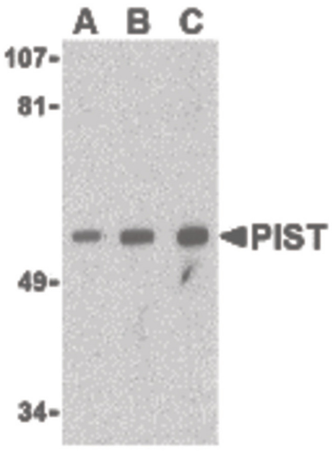 GOPC / PIST Antibody - Western blot of PIST in PC-3 cell lysate with PIST antibody at (A) 1, (B) 2 and (C) 4 ug/ml.
