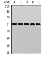 GOPC / PIST Antibody - Western blot analysis of PIST expression in HepG2 (A); HeLa (B); mouse kidney (C); mouse liver (D); rat brain (E) whole cell lysates.
