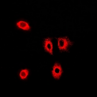 GOPC / PIST Antibody - Immunofluorescent analysis of PIST staining in A549 cells. Formalin-fixed cells were permeabilized with 0.1% Triton X-100 in TBS for 5-10 minutes and blocked with 3% BSA-PBS for 30 minutes at room temperature. Cells were probed with the primary antibody in 3% BSA-PBS and incubated overnight at 4 deg C in a humidified chamber. Cells were washed with PBST and incubated with a DyLight 594-conjugated secondary antibody (red) in PBS at room temperature in the dark.