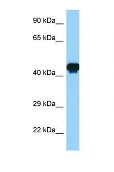 GORAB / SCYL1BP1 Antibody - GORAB / SCYL1BP1 antibody Western blot of Fetal Brain lysate. Antibody concentration 1 ug/ml.  This image was taken for the unconjugated form of this product. Other forms have not been tested.