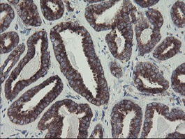 GORAB / SCYL1BP1 Antibody - IHC of paraffin-embedded Carcinoma of Human prostate tissue using anti-GORAB mouse monoclonal antibody. (Heat-induced epitope retrieval by 10mM citric buffer, pH6.0, 100C for 10min).