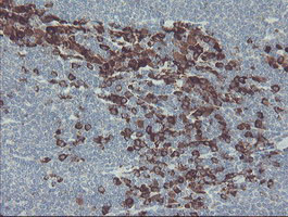 GORAB / SCYL1BP1 Antibody - IHC of paraffin-embedded Human lymphoma tissue using anti-GORAB mouse monoclonal antibody. (Heat-induced epitope retrieval by 10mM citric buffer, pH6.0, 100C for 10min).
