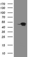 GORAB / SCYL1BP1 Antibody - HEK293T cells were transfected with the pCMV6-ENTRY control (Left lane) or pCMV6-ENTRY GORAB (Right lane) cDNA for 48 hrs and lysed. Equivalent amounts of cell lysates (5 ug per lane) were separated by SDS-PAGE and immunoblotted with anti-GORAB.