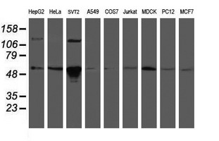 GORAB / SCYL1BP1 Antibody - Western blot of extracts (35ug) from 9 different cell lines by using anti-GORAB monoclonal antibody (HepG2: human; HeLa: human; SVT2: mouse; A549: human; COS7: monkey; Jurkat: human; MDCK: canine; PC12: rat; MCF7: human).