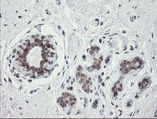 GORAB / SCYL1BP1 Antibody - IHC of paraffin-embedded Human breast tissue using anti-GORAB mouse monoclonal antibody.