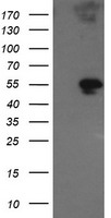 GORAB / SCYL1BP1 Antibody - HEK293T cells were transfected with the pCMV6-ENTRY control (Left lane) or pCMV6-ENTRY GORAB (Right lane) cDNA for 48 hrs and lysed. Equivalent amounts of cell lysates (5 ug per lane) were separated by SDS-PAGE and immunoblotted with anti-GORAB.