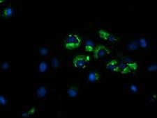 GORAB / SCYL1BP1 Antibody - Anti-GORAB mouse monoclonal antibody immunofluorescent staining of COS7 cells transiently transfected by pCMV6-ENTRY GORAB.