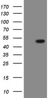 GORAB / SCYL1BP1 Antibody - HEK293T cells were transfected with the pCMV6-ENTRY control (Left lane) or pCMV6-ENTRY GORAB (Right lane) cDNA for 48 hrs and lysed. Equivalent amounts of cell lysates (5 ug per lane) were separated by SDS-PAGE and immunoblotted with anti-GORAB.