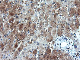 GORAB / SCYL1BP1 Antibody - IHC of paraffin-embedded Human liver tissue using anti-GORAB mouse monoclonal antibody.