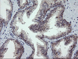 GORAB / SCYL1BP1 Antibody - IHC of paraffin-embedded Human prostate tissue using anti-GORAB mouse monoclonal antibody.