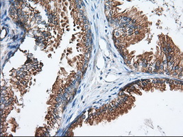 GORASP1 / GRASP65 Antibody - Immunohistochemical staining of paraffin-embedded Human prostate tissue using anti-GORASP1 mouse monoclonal antibody. (Dilution 1:50).