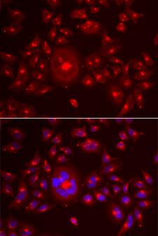 GORASP1 / GRASP65 Antibody - Immunofluorescence analysis of A549 cells.