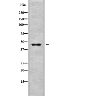 GORASP1 / GRASP65 Antibody - Western blot analysis GORASP1 using Jurkat whole cells lysates