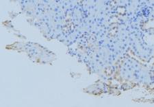GORASP1 / GRASP65 Antibody - 1:100 staining mouse kidney tissue by IHC-P. The sample was formaldehyde fixed and a heat mediated antigen retrieval step in citrate buffer was performed. The sample was then blocked and incubated with the antibody for 1.5 hours at 22°C. An HRP conjugated goat anti-rabbit antibody was used as the secondary.