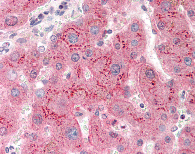 GORASP1 / GRASP65 Antibody - Human Liver: Formalin-Fixed, Paraffin-Embedded (FFPE).  This image was taken for the unconjugated form of this product. Other forms have not been tested.