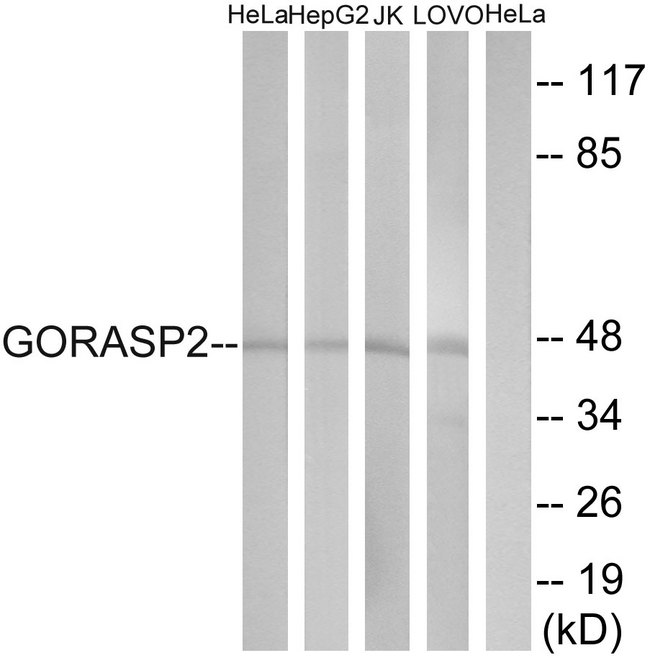 GORASP2 / GRASP55 Antibody - Western blot analysis of lysates from HeLa, HepG2, Jurkat, and LOVO cells, using GORASP2 Antibody. The lane on the right is blocked with the synthesized peptide.
