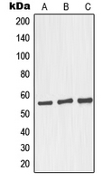 GORASP2 / GRASP55 Antibody - Western blot analysis of GRASP55 expression in HepG2 (A); Raji (B); LOVO (C) whole cell lysates.