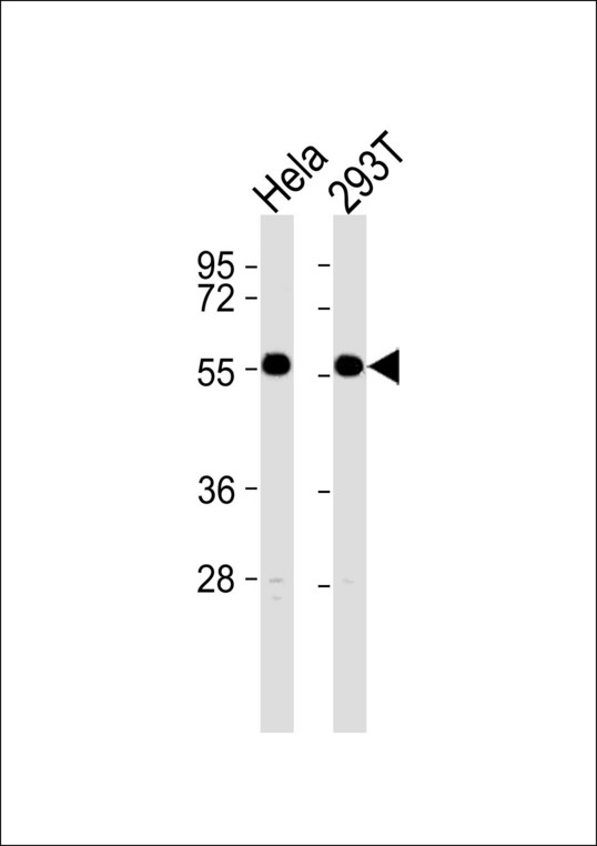 GORASP2 / GRASP55 Antibody - All lanes : Anti-GRASP55 Antibody at 1:1000 dilution Lane 1: HeLa whole cell lysates Lane 2: 293T whole cell lysates Lysates/proteins at 20 ug per lane. Secondary Goat Anti-Rabbit IgG, (H+L),Peroxidase conjugated at 1/10000 dilution Predicted band size : 47 kDa Blocking/Dilution buffer: 5% NFDM/TBST.