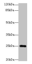 GOSR2 / Membrin Antibody - Western blot All lanes: GOSR2 antibody at 4µg/ml Lane 1: Jurkat whole cell lysate Lane 2: HepG2 whole cell lysate Secondary Goat polyclonal to rabbit IgG at 1/10000 dilution Predicted band size: 25, 23 kDa Observed band size: 25 kDa