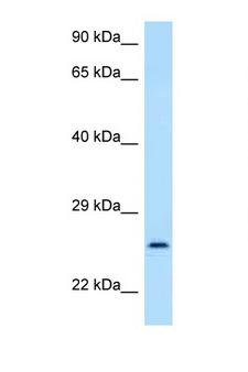 GOSR2 / Membrin Antibody - GOSR2 antibody Western blot of 435S Cell lysate. Antibody concentration 1 ug/ml.  This image was taken for the unconjugated form of this product. Other forms have not been tested.