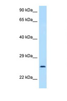 GOSR2 / Membrin Antibody - GOSR2 antibody Western blot of 435S Cell lysate. Antibody concentration 1 ug/ml.  This image was taken for the unconjugated form of this product. Other forms have not been tested.