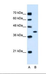 GOT2 Antibody - Lane A: Marker. Lane B: HepG2 cell lysate. Antibody concentration: 1.25 ug/ml. Gel concentration: 12%.  This image was taken for the unconjugated form of this product. Other forms have not been tested.
