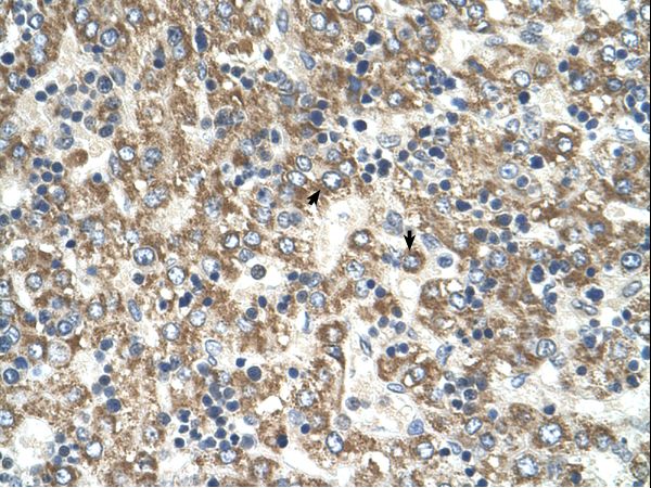 GOT2 Antibody - GOT2 antibody GOT2(glutamic-oxaloacetic transaminase 2, mitochondrial (aspartate aminotransferase 2)) Antibody was used in IHC to stain formalin-fixed, paraffin-embedded human liver.  This image was taken for the unconjugated form of this product. Other forms have not been tested.