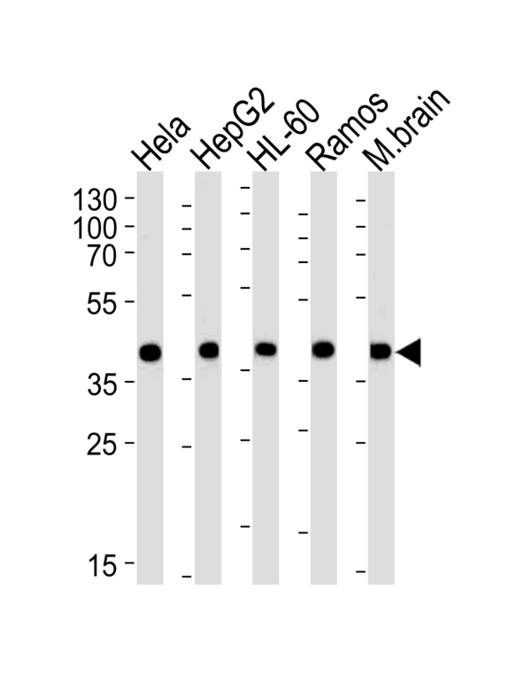 GOT2 Antibody - Western blot of lysates from HeLa, HepG2, HL-60, Ramos, mouse brain cell line (from left to right), using GOT2 Antibody. Antibody was diluted at 1:1000 at each lane. A goat anti-rabbit IgG H&L (HRP) at 1:5000 dilution was used as the secondary antibody. Lysates at 35ug per lane.